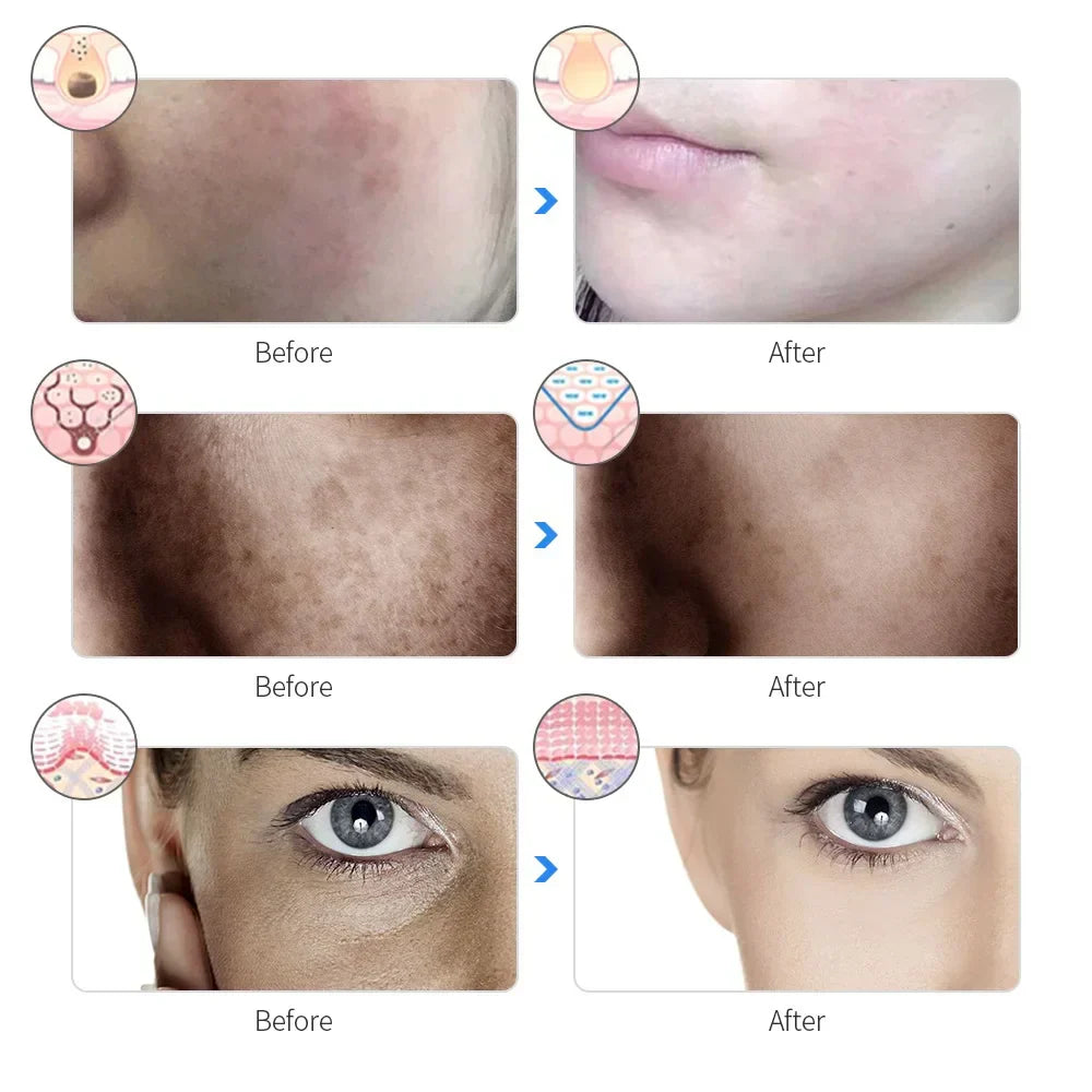LED Facial Mask - Skin Rejuvenation & Beauty Device