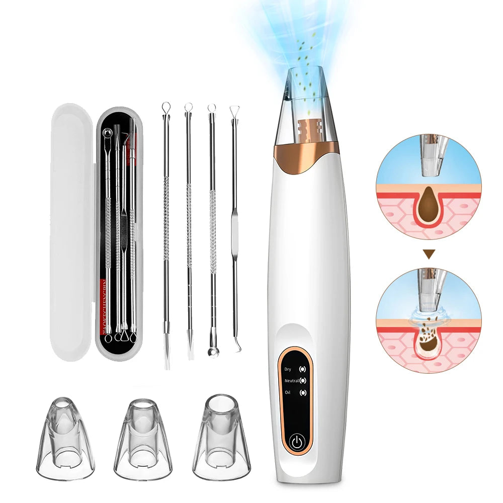 Elektrischer Mitesser-Entferner – Gesicht & Nase Porenreiniger